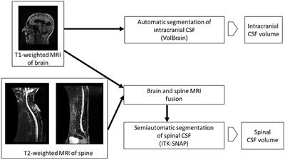 Predictive value of spinal CSF volume in the preoperative assessment of patients with idiopathic normal-pressure hydrocephalus